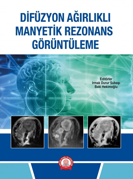 Difüzyon Ağırlıklı Manyetik Rezonans Görüntüleme ürün görseli 1