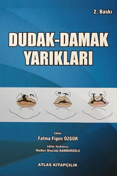 Dudak Damak Yarıkları