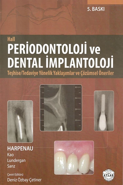 Periodontoloji ve Dental İmplantoloji - Hall ürün görseli