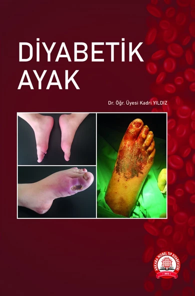 Diyabetik Ayak ürün görseli 1