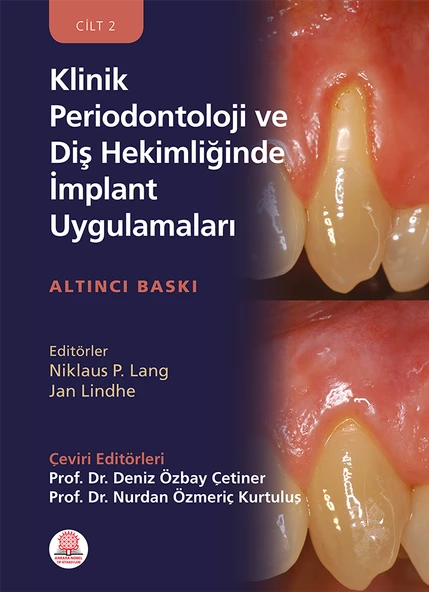 Klinik Periodontoloji ve Diş Hekimliğinde İmplant Uygulamaları - Resim 3