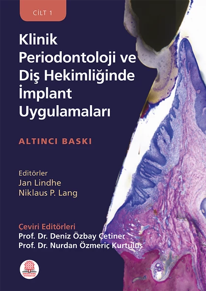 Klinik Periodontoloji ve Diş Hekimliğinde İmplant Uygulamaları - Resim 2