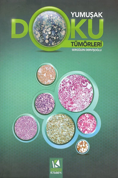 Yumuşak Doku Tümörleri ürün görseli