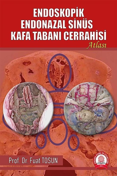 Endoskopik Endonazal Sinüs Kafa Tabanı Cerrahisi ürün görseli 1