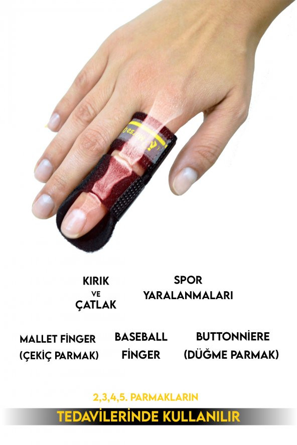 MORSA CYBERG® Phalango Fix Parmak Sabitleme Parmak Ateli STANDART BEDEN - 4