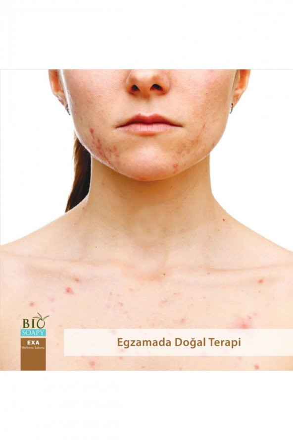 2 Adet Biosoapy Doğal Welness Exa Egzama Sabunu 100 Gr / Adet (egzamada Doğal Terapi) EXA - 5
