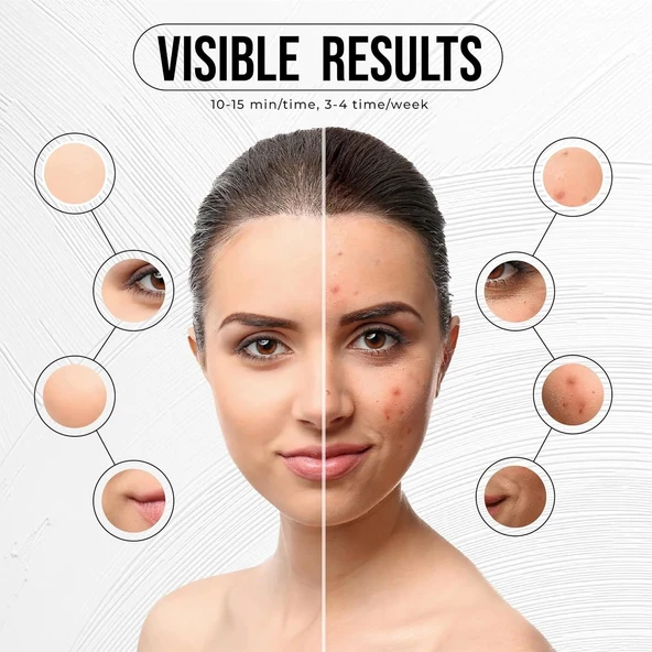 PureRadiance Yüz için LED Kırmızı Işık Terapi Maskesi, 7 Renk Modu - 4