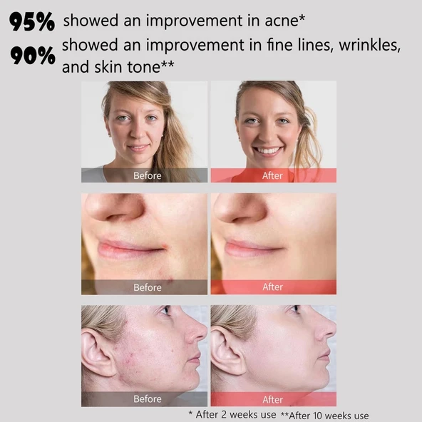 Aphrona - Halo Led Işık Terapisi - Yüz ve Boyun için Cilt Bakım Maskesi - 4