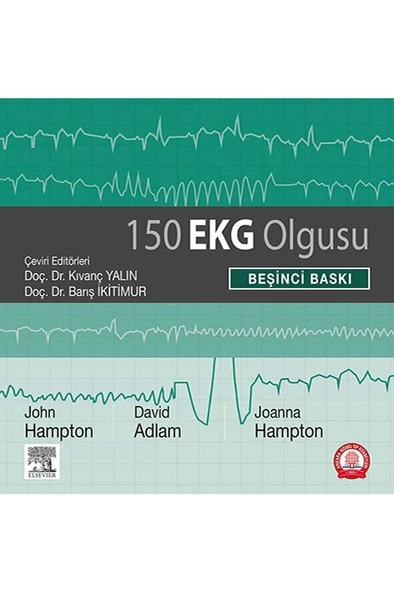 150 EKG Olgusu - Resim 2