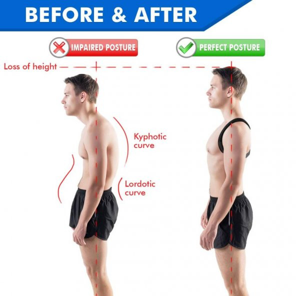 Unisex Standart Beden Dik Duruş Korsesi (Siyah) - 3