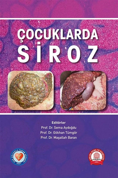 Çocuklarda Siroz ürün görseli 1