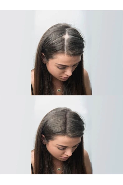 Jaja Saç Topiği Siyah(BLACK) 50 gr Saç Fiberi Toppik Siyah Topic - 3