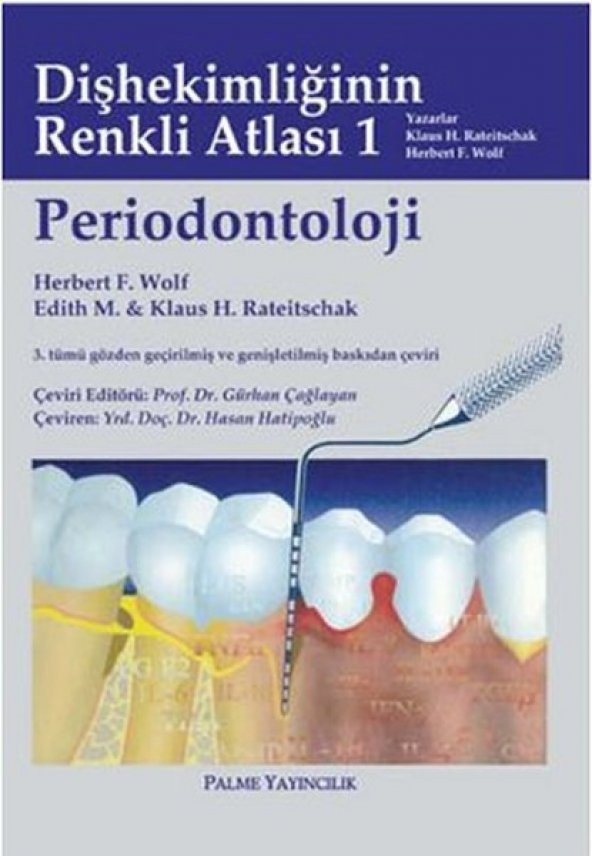 Periodontoloji -palme