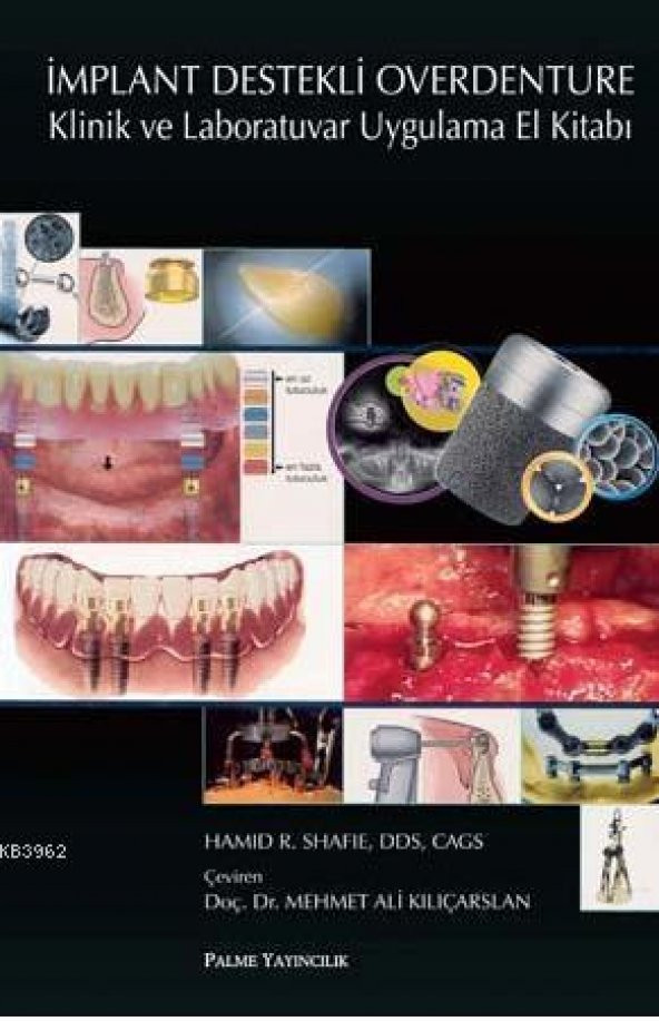 İmplant Destekli Overdenture Klinik Ve - Palme Yay