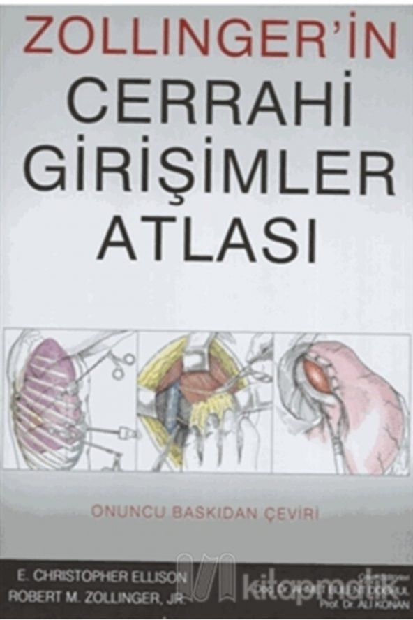 Zollıngerin Cerrahi Girişimler Atlası  Palme