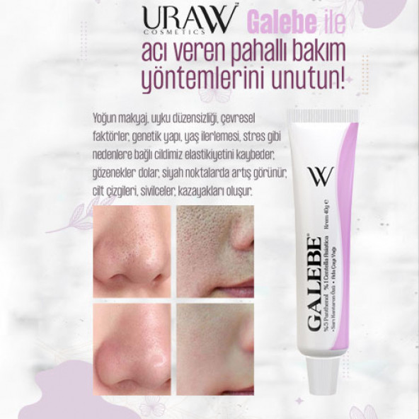 Uraw Galebe Onarıcı Krem - 4