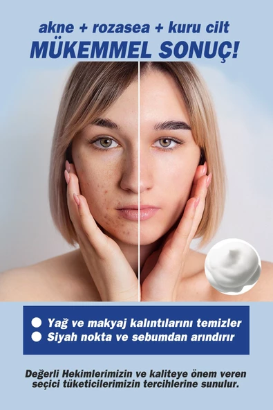 TTO Köpük Solüsyon 200 ml - 3