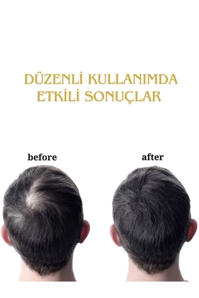 FORX5 Sarı Serum& Dermaroller Set - 3