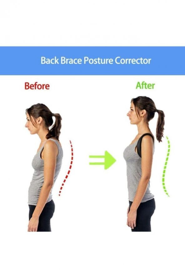 Dik Durmak Için Ortopedik Kamburluk Önleyici Dik Duruş Bel Sırt Omuz Korsesi - Resim 3