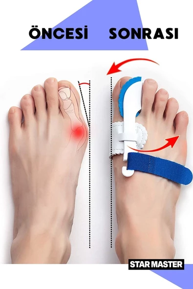 Star Master Baş Parmak Düzeltici Aparat Ayak Parmak Kemik Düzeltici Ateli Bunyon - 4