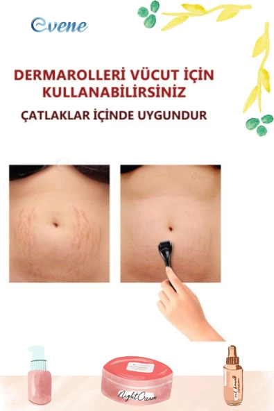 Evene Dermaroller Saç Çıkarma Tarağı İğneli Tarak Saç Rulosu Roller 1 mm Saklama Kabı - Resim 7