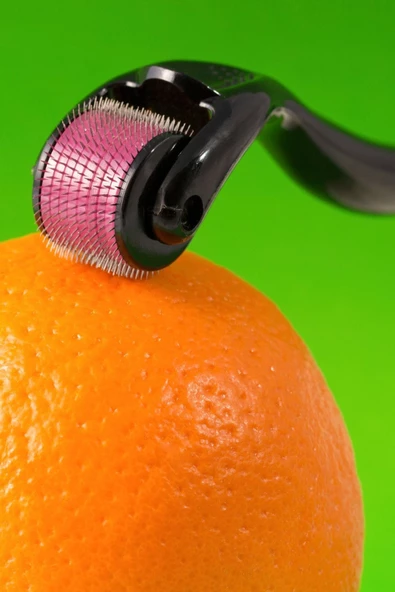 Viselia Saç Çıkarma Tarağı - Titanyum Iğneli Derma Roller Cilt Yenileme 0.5 Mm