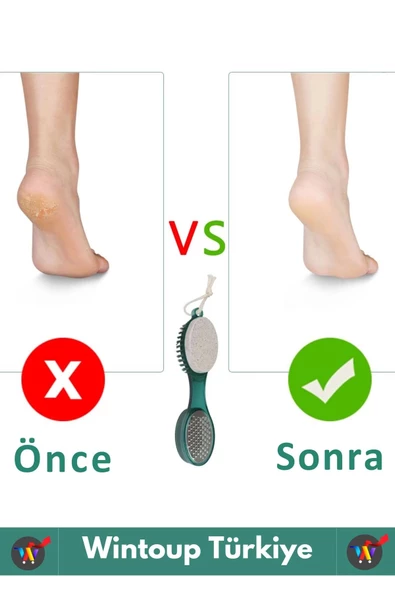Premium Seri Yüksek Kaliteli Ayak Topuk Bakım 4 in 1 Multifonksiyonel Ayak Topuk Bakım Aleti Törpü - 4
