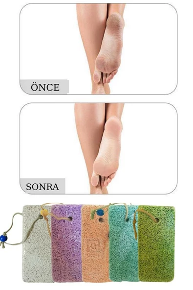 QNİAY Pomza Taşı (7 Adet) Cilt Topuk Kazıyıcı Peeling Banyo Pedikür Manikür Nasır Doğal Ayak Bakımı - 2
