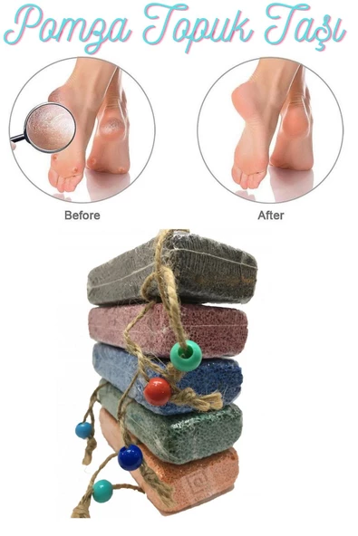 QNİAY Topuk Taşı Doğal Pomza El Ayak Bakım Nasır Taşı (1 Adet) Manikür Pedikür Cilt Bakım - 4