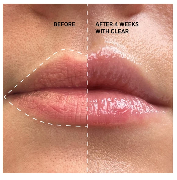 THE INKEY LIST Tripeptide Plumping Lip Balm Pink - Dolgunlaştırıcı Dudak Balmı 10 ml - Resim 4