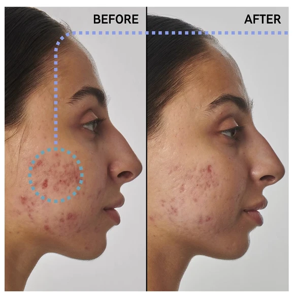 THE INKEY LIST Scar, mark and wrinkle solution with 1% retinol - Yüz Serumu 30 ml - 2