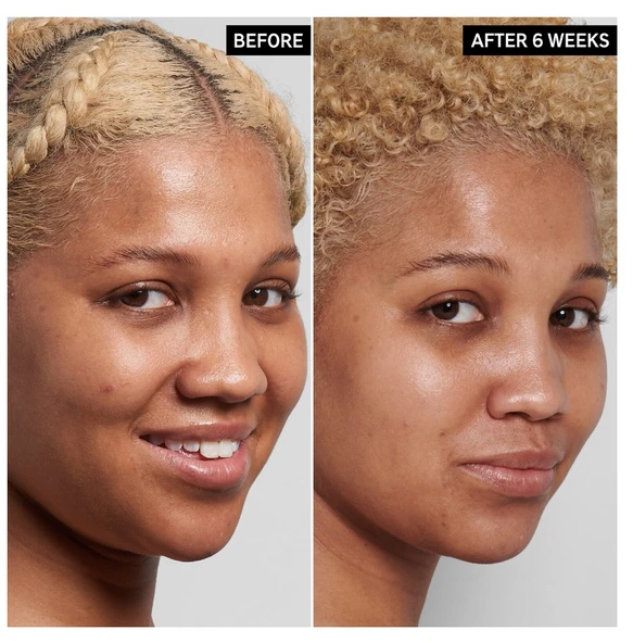 THE INKEY LIST NIACINAMIDE - Serum 30 ml - Resim 2