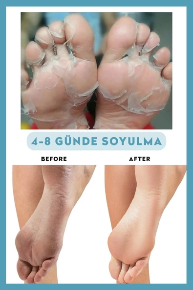 Dermokil Peeling Etkili Soyulabilir Ayak Maskesi 30 ml - Resim 4