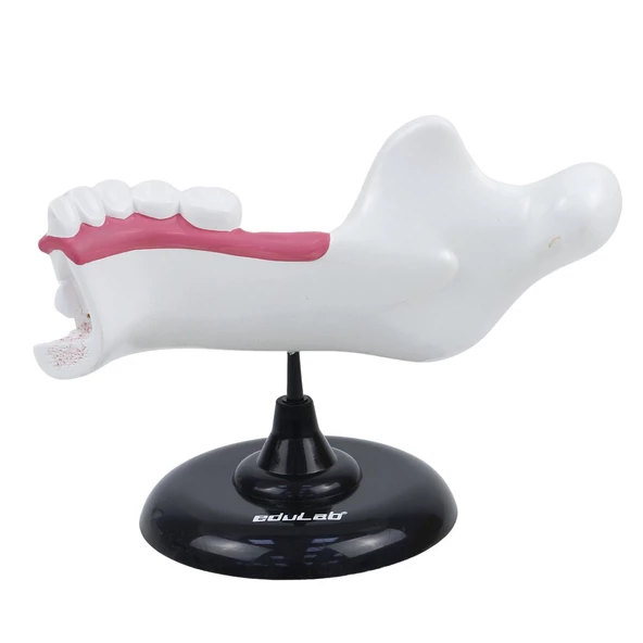 YARIM ÇENE DİŞ MODELİ - Resim 4