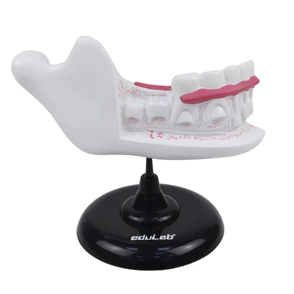 YARIM ÇENE DİŞ MODELİ - Resim 2