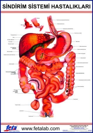 Sindirim Sistemi Hastalıkları Eğitim Plakası