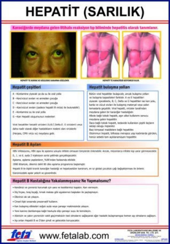 Hepatit Eğitim Plakası - 1