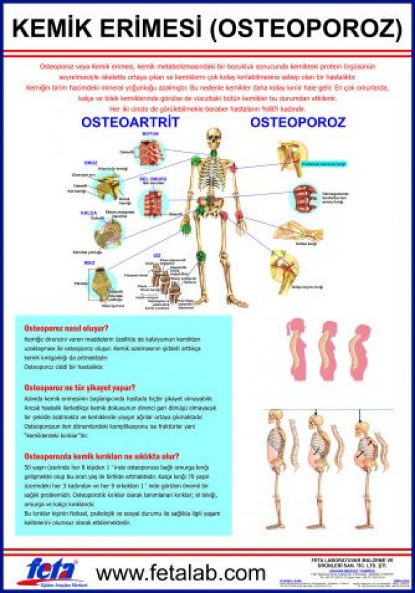 Osteoporoz Eğitim Plakası (KEMİK ERİMESİ)