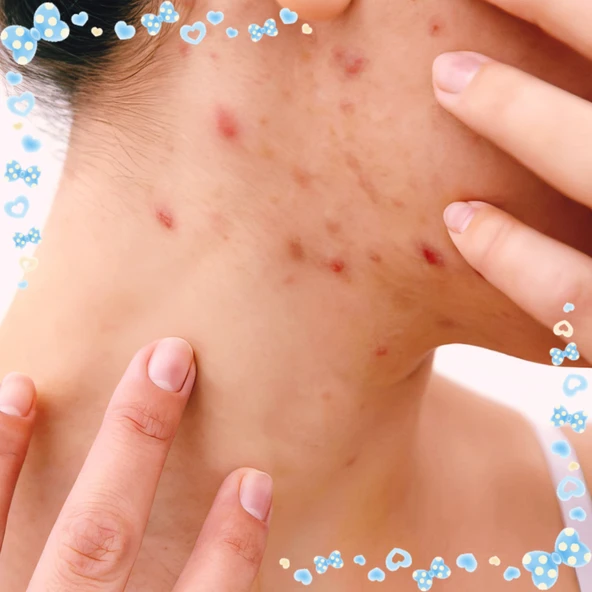 ORGANICYOU KÜKÜRTLÜ UYUZ KARŞITI CİLT BAKIM KREMİ 100 ML - 4