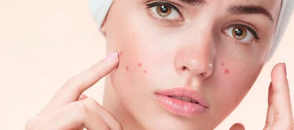 ORGANICYOU SEBIUM AKNE KARŞITI DOĞAL CİLT BAKIM KREMİ 100 ML - 4