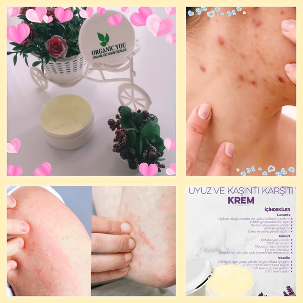 ORGANICYOU KÜKÜRTLÜ UYUZ KARŞITI CİLT BAKIM KREMİ 100 ML - 3