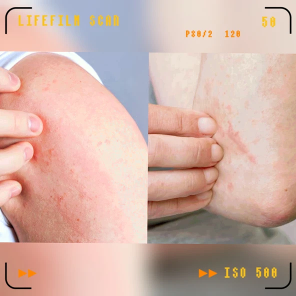 OrganıcYou Tedavi Edici Doğal Bitkisel EGZAMA TERAPİKremi 50 ml - 3