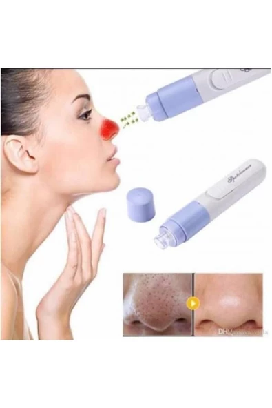 Pazariz Pazarız Vakumlu Siyah Nokta Akne Cilt Temizleyici