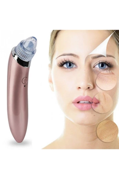 Pazariz Vakumlu Akne Ve Siyah Nokta Temizleme Cihazı - 3