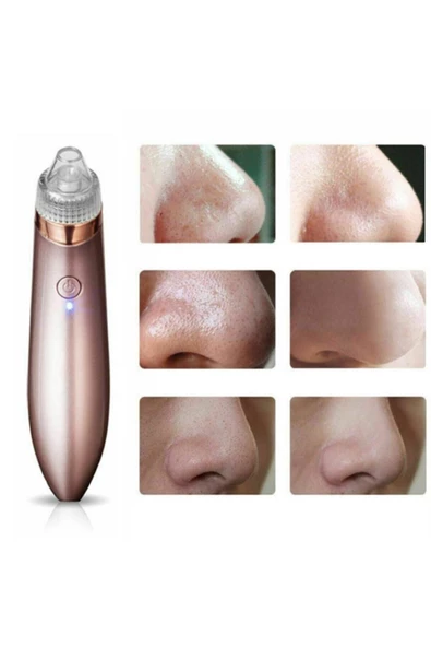 Pazariz Vakumlu Akne Ve Siyah Nokta Temizleme Cihazı - 2