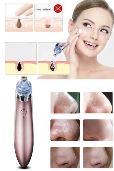 Pazariz 4başlıklı Şarjlı Yüz Gözenek Temizleyici Siyah Nokta Çıkarıcı Akne Sökücü Dermabrazyon - 2