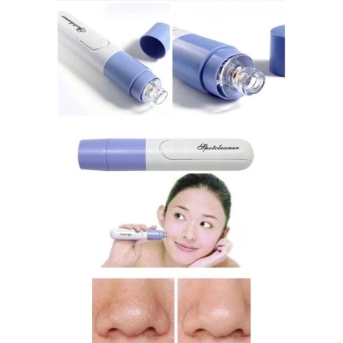Pore Cleaner Vakumlu Yüz Temizleme Siyah Nokta Temizleme Cihazı - 2