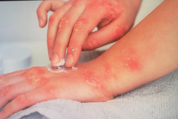 MASTER OF ORGANİC ORGANICYOU GENÇLİK KREMİ KIRIŞIKLIK 50 ML+ CİLT İYİLEŞTİRİCİ & RAHATLATICI KREM 50 - 5