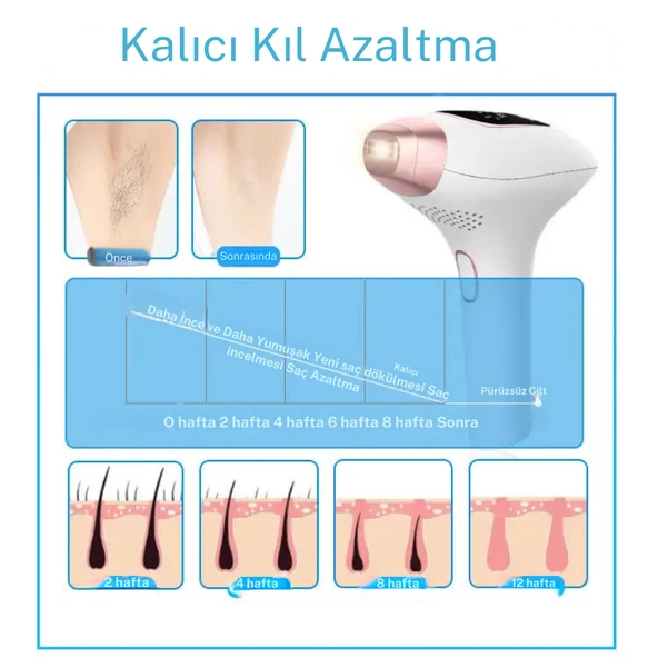 Trend Farma Soğuk Buz İpl Lazer Epilasyon Cihazı - 999.999 Atım,  Ağrısız buz lazer - 5