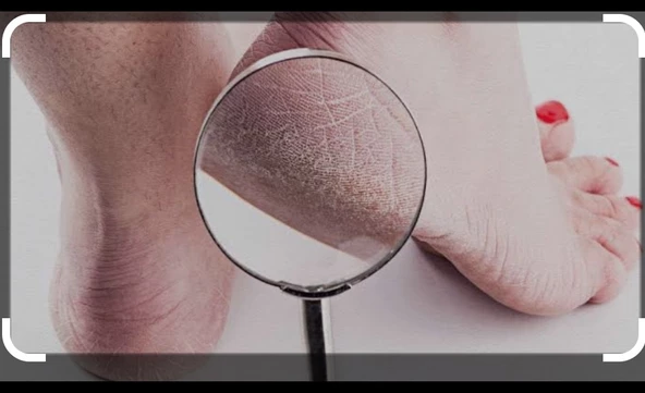 ORGANICYOU AYAK BAKIM ve ÇATLAK & KOKU BIOTERAPİ KREMİ 100 ML - 7